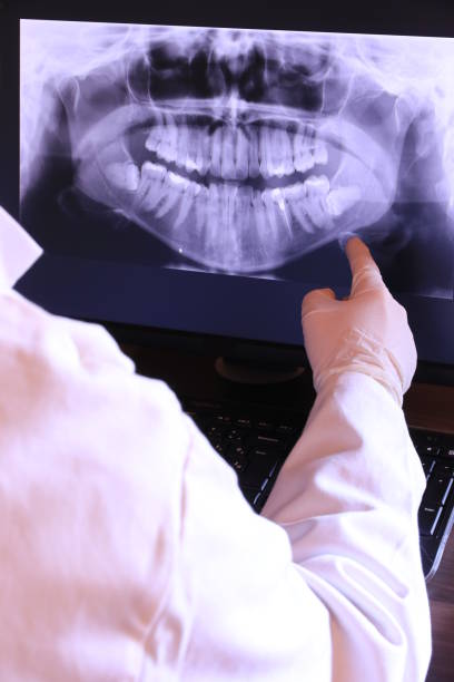 Best Emergency Tooth Extraction in Gladewater, TX