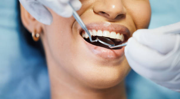 Best Emergency Treatment for Dental Infections or Abscesses in Gladewater, TX
